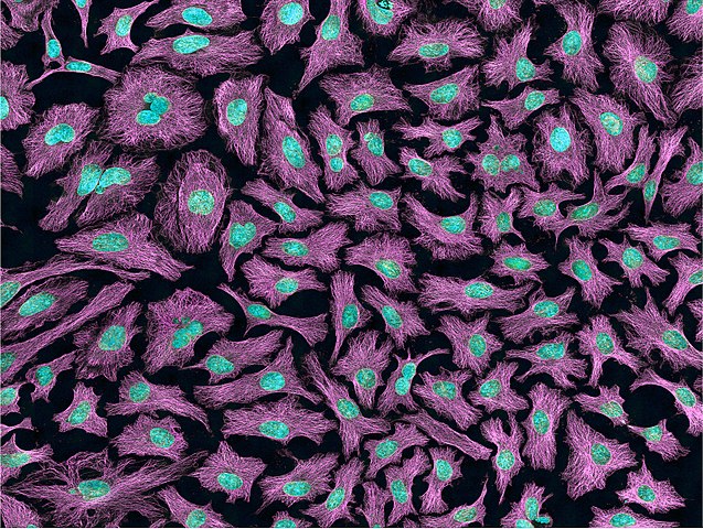 Henrietta Lacks, The Mother Of Modern Medicine